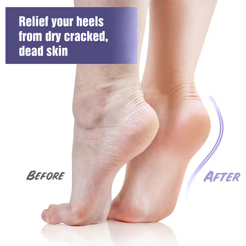 Soft-Feel Gel Heel Moisture Socks for Supporting Deep Nourishment, Enhancing Heel Smoothness, And Creating a Protective Layer That Helps Improve Dry, Rough Skin During Foot Care Sessions